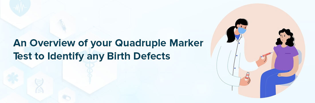 An Overview of your Quadruple Marker Test to Identify any Birth Defects